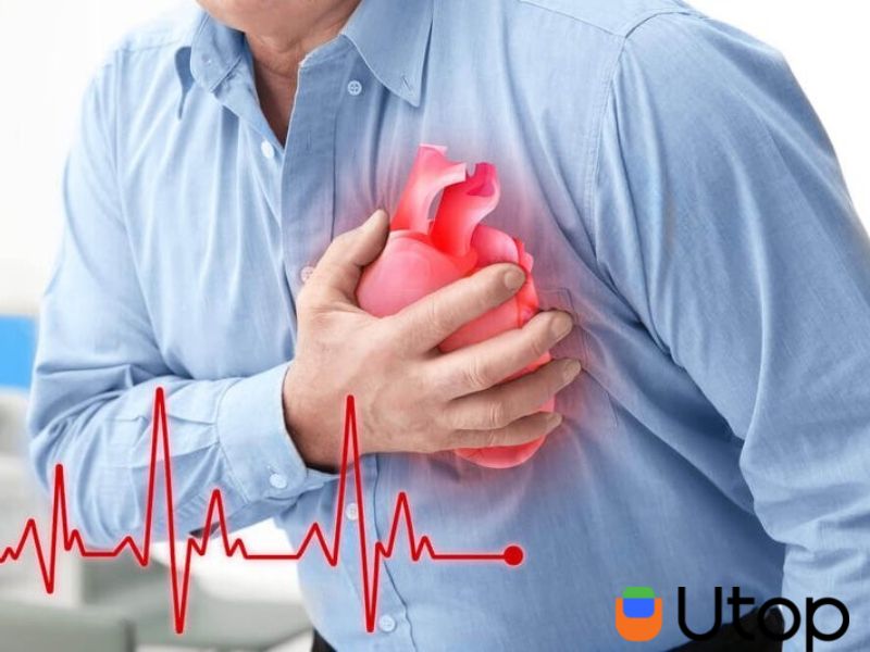 Nguyên nhân cao huyết áp - Loạn nhịp tim